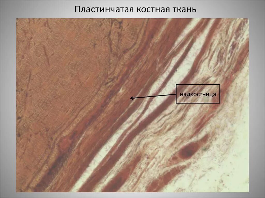 Продольный срез кости гистология. Пластинчатая костная ткань гистология. Пластинчатая костная ткань гистология продольный срез. Пластичная костная ткань гистология. Пластинчатая кость