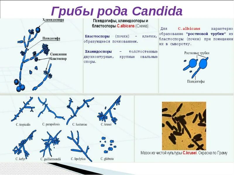 Candida spp ниже порогового значения что это. Грибок рода кандида граму. грибы рода кандида окраска по граму. candida albicans бластоспоры.