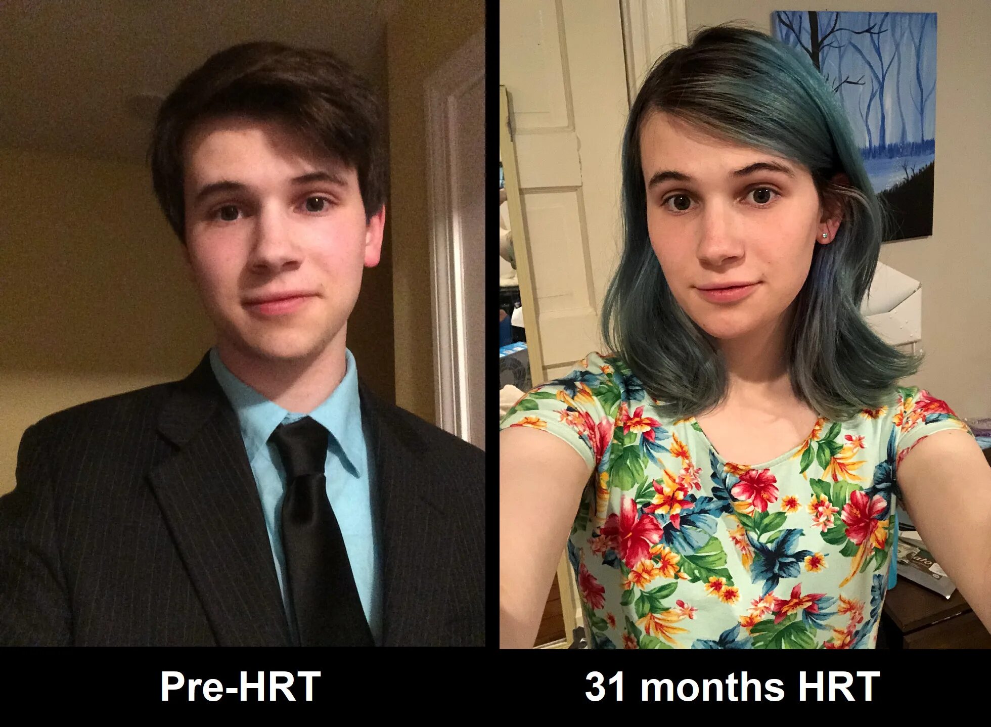 Транс парень это. Транчгейдкри до и после. Трансгендеры до и после. Смена пола. Симпатичные трансгендеры до и после.