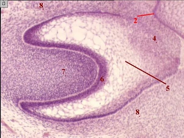 Стадии развития зуба. Ранняя стадия развития зуба гистология препарат. Зачаток зуба препарат гистология. Гистогенез зуба гистология. Стадия закладки зубного зачатка гистология.