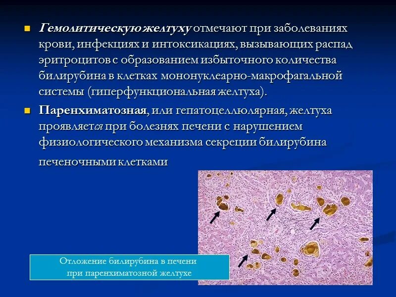 Распад эритроцитов. Причины токсической дистрофии печени. Макрофагальная реакция. Кровяные инфекционные заболевания.