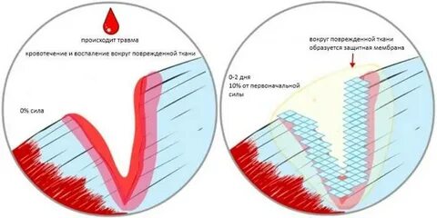 Восстановление разрывов