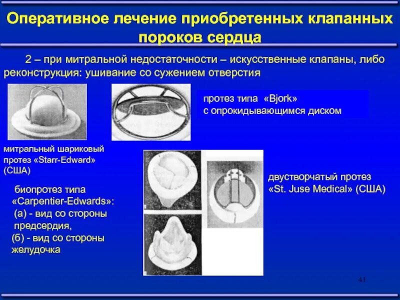 Как клапан делает операция. Принципы хирургического лечения приобретенных пороков сердца. Хирургическое лечение приобретенных пороков сердца. Операции при клапанных пороках сердца. Пороки сердца Оперативная хирургия.