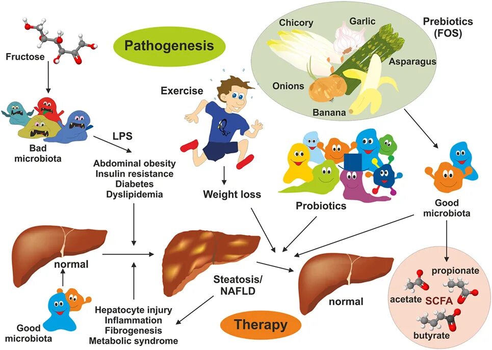 Печень и микробиота. Gut microbiota NAFLD. Плакат дислипидемия. Фруктоза и печень