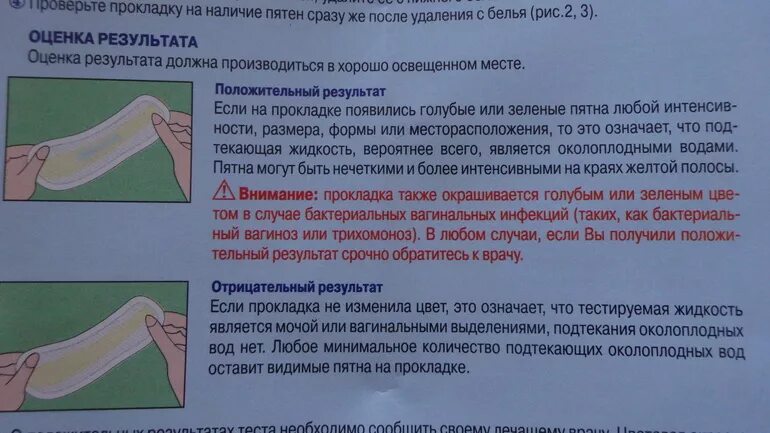 27 недель беременности отошли воды. Подтекание околоплодных вод. Как понять что подтекают воды. Подтекают околоплодные воды. Как выглядит подтекание вод.