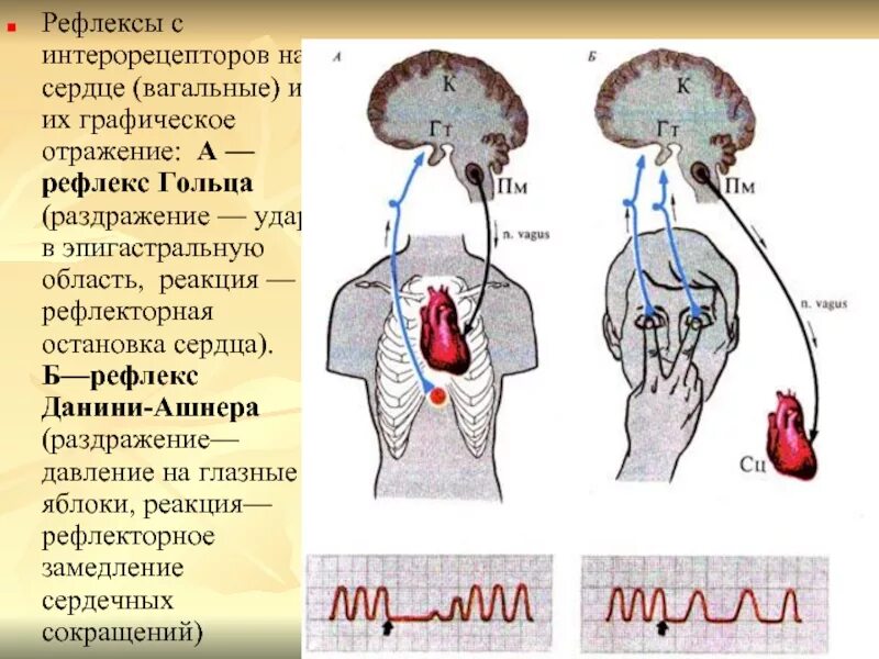 Реакция сердечко