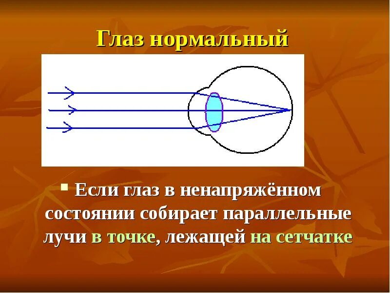 Точка лежащая зрение. Близорукость схема физика. Близорукость фокус. Близорукость презентация. Близорукость и нормальный глаз.