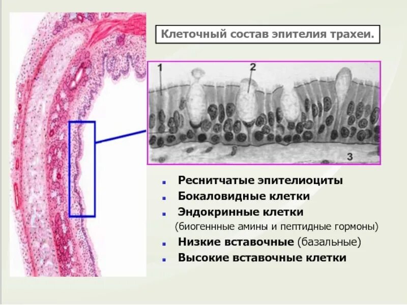 Эпителий трахеи клетки