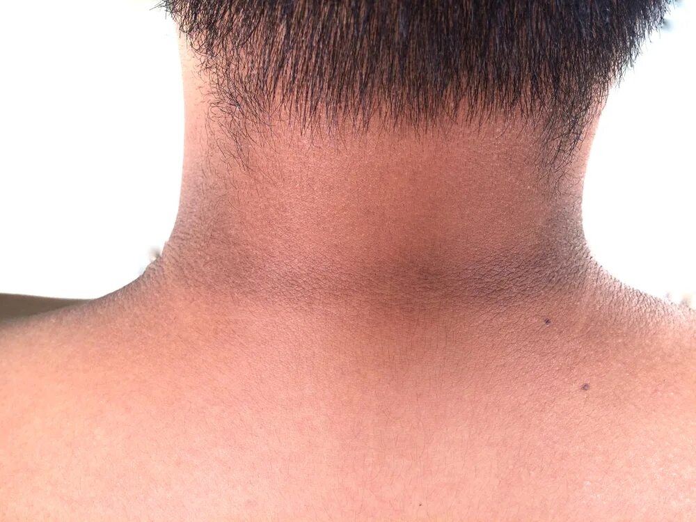 Complete with the necks
