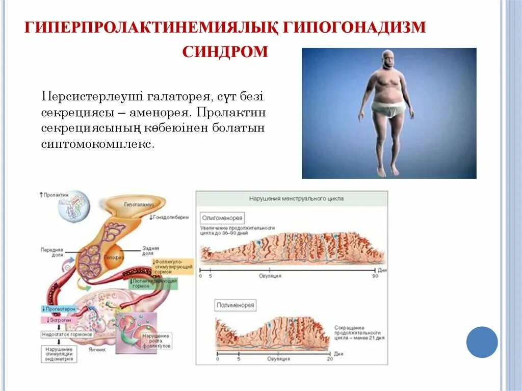 Гипергонадотропный гипергонадизм. Первичный гипогонадизм. Гипогонадотропный гипогонадизм. Вторичный гипогонадизм. Гипогонадизм у мужчин лечение