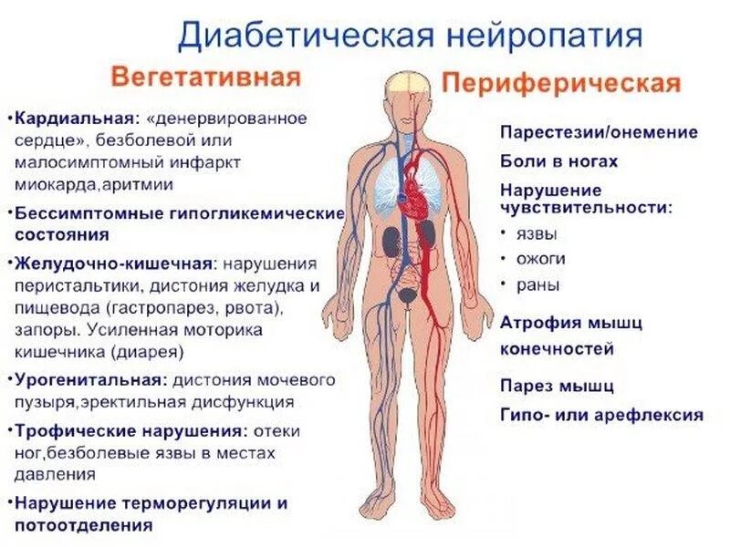 Периферические нервы симптомы. Клинические симптомы диабетической нейропатии. Сахарный диабет полинейропатия. Симптомы диабетической периферической нейропатии. Диабетическая периферическая полинейропатия симптомы.