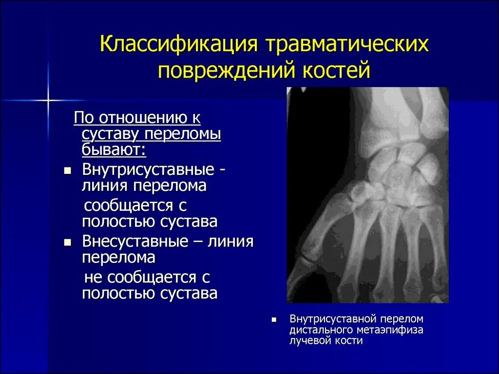 Перелом кости может быть каким. Лучевая диагностика травматических повреждений костей. Рентгенодиагностика перелом кости. Рентгенодиагностика травматических повреждений костей и суставов.