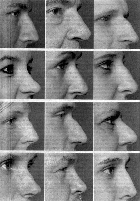 Рост носа в год. Разные формы носа. Разные носы. Разные формы носа в профиль. Типы профилей лица.