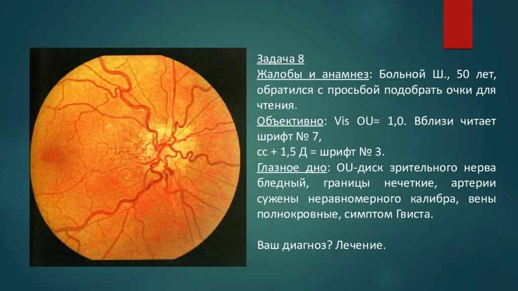 Ангиопатия сетчатки глазное дно. Офтальмоскопическая картина глазного дна. Ишемическая нейропатия глазное дно. Гемералопия глазное дно.