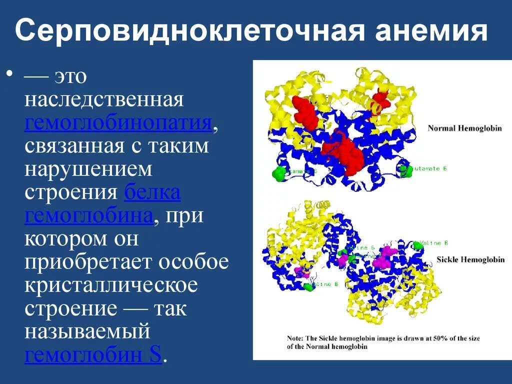 Ген серповидноклеточной анемии. Гемоглобин серповидноклеточная анемия. Серповидноклеточная анемия биохимия. Структура гемоглобина при серповидноклеточной анемии. Серповидно-клеточная Аннми биотмия.