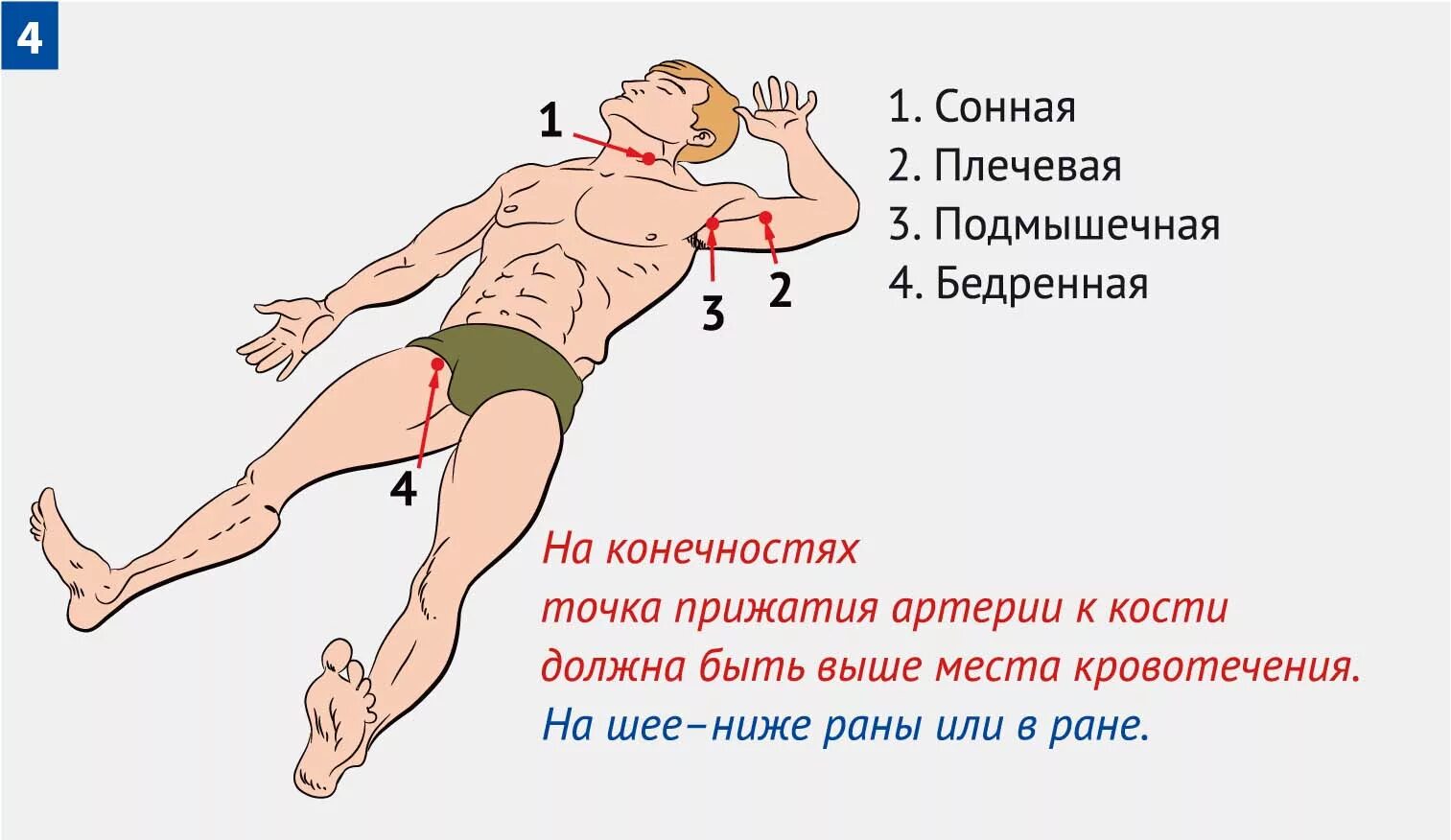 Моментальная точка. Точки прижатия артерий. Точки прижатия артерий при кровотечении. Места прижатия артерий при кровотечениях. Точки прижатия артерий для остановки артериального кровотечения.