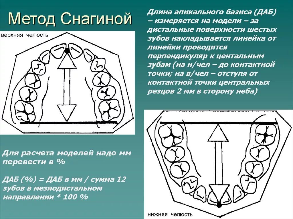 Длина базиса. Измерение апикального базиса челюстей в ортодонтии. Таблица хауса Снагиной. Метод Коркхауза в ортодонтии. Метод хауса Снагиной в ортодонтии.