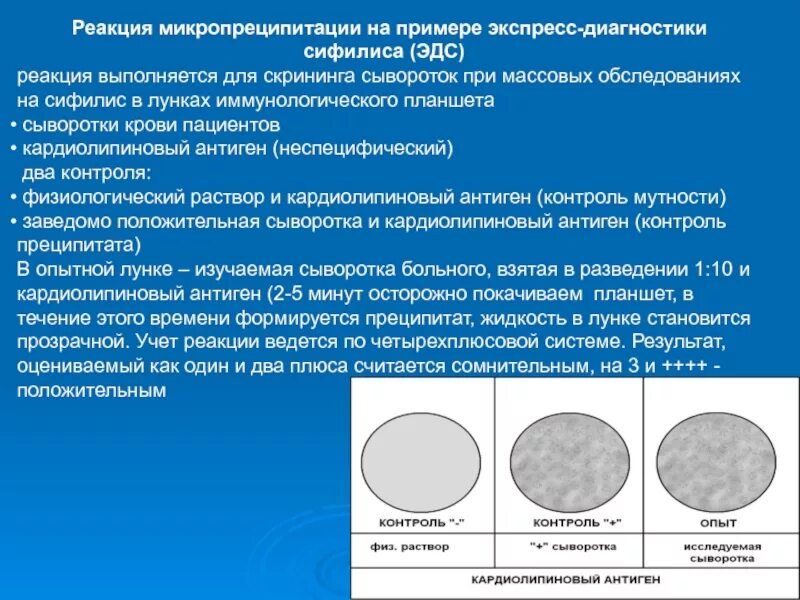 Объясните результат реакции. Механизм реакции микропреципитации. Экспресс метод диагностики сифилиса РМП методика. Диагностика сифилиса реакция микропреципитации. Микрореакция преципитации с кардиолипиновым антигеном.