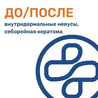 Мосдерм