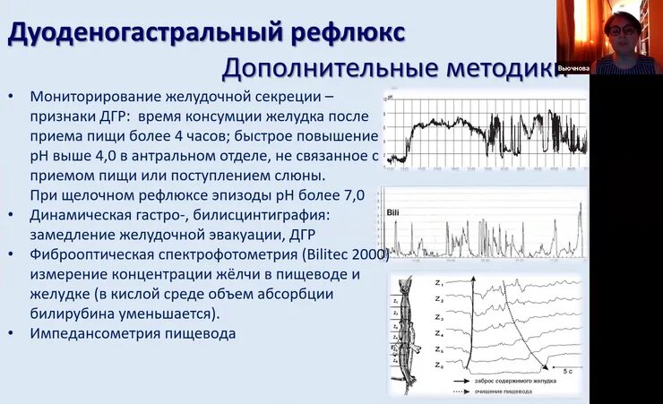 Рефлюкс дуоденогастральный симптомы