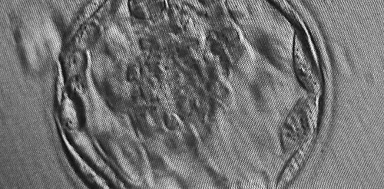 Бластоцисты (blastocystis spp. Бластоциста под микроскопом. Бластоциста в калле. Бластоциста человека под микроскопом. Цисты бластоцисты хоминис.
