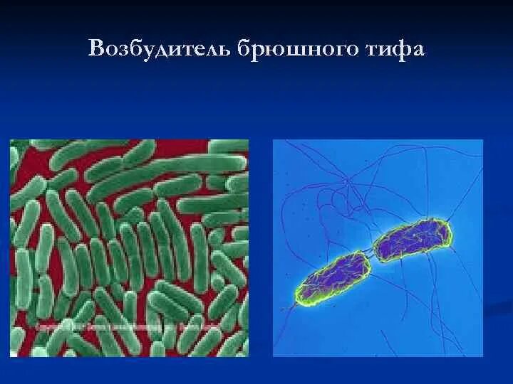 Бактерия сальмонелла Тифи. Возбудитель тифа бактерия. Брюшной тиф возбудитель бактерия. Микроорганизм возбудитель брюшного тифа. Сальмонеллез и брюшной тиф