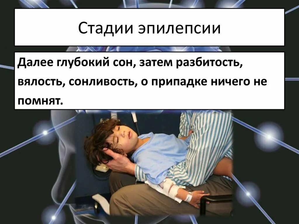 Можно ли кофе при эпилепсии. Стадии эпилепсии. этапы эпилепсии. этапы эпилептического припадка.