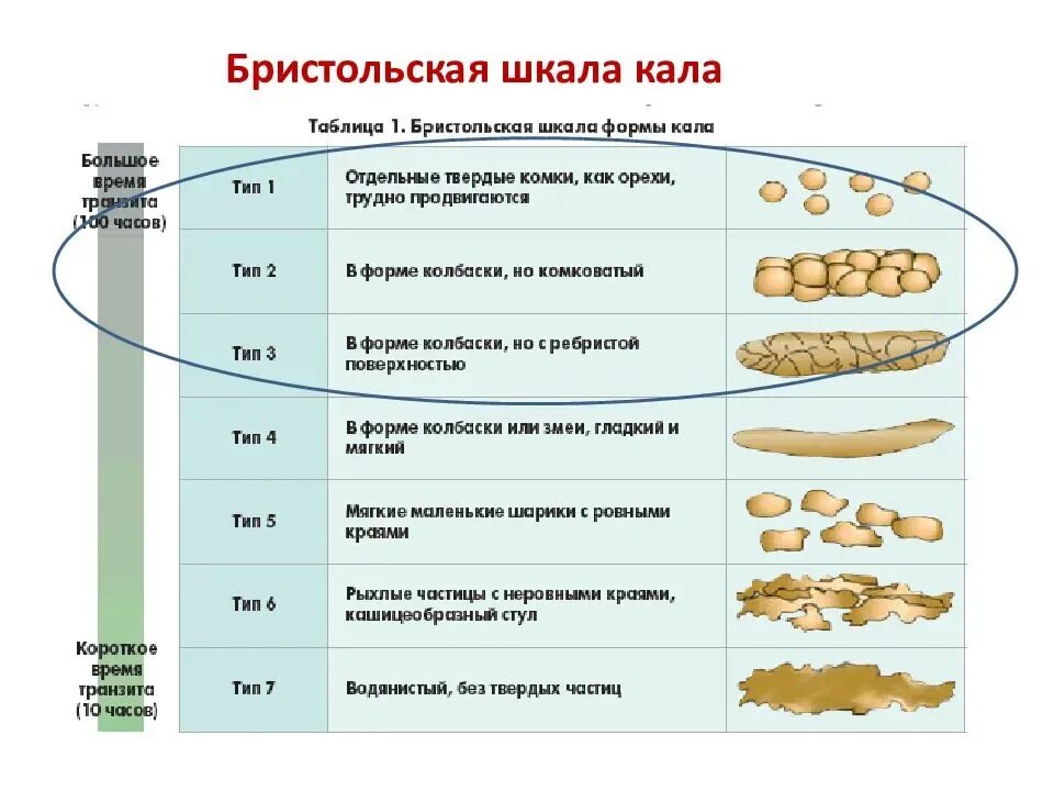 Кал у взрослого человека норма. Бристольская шкала формы стула Тип 2. Бристольская классификация формы кала. Стул Тип 6 по Бристольской шкале. Норма кала по Бристольской шкале.