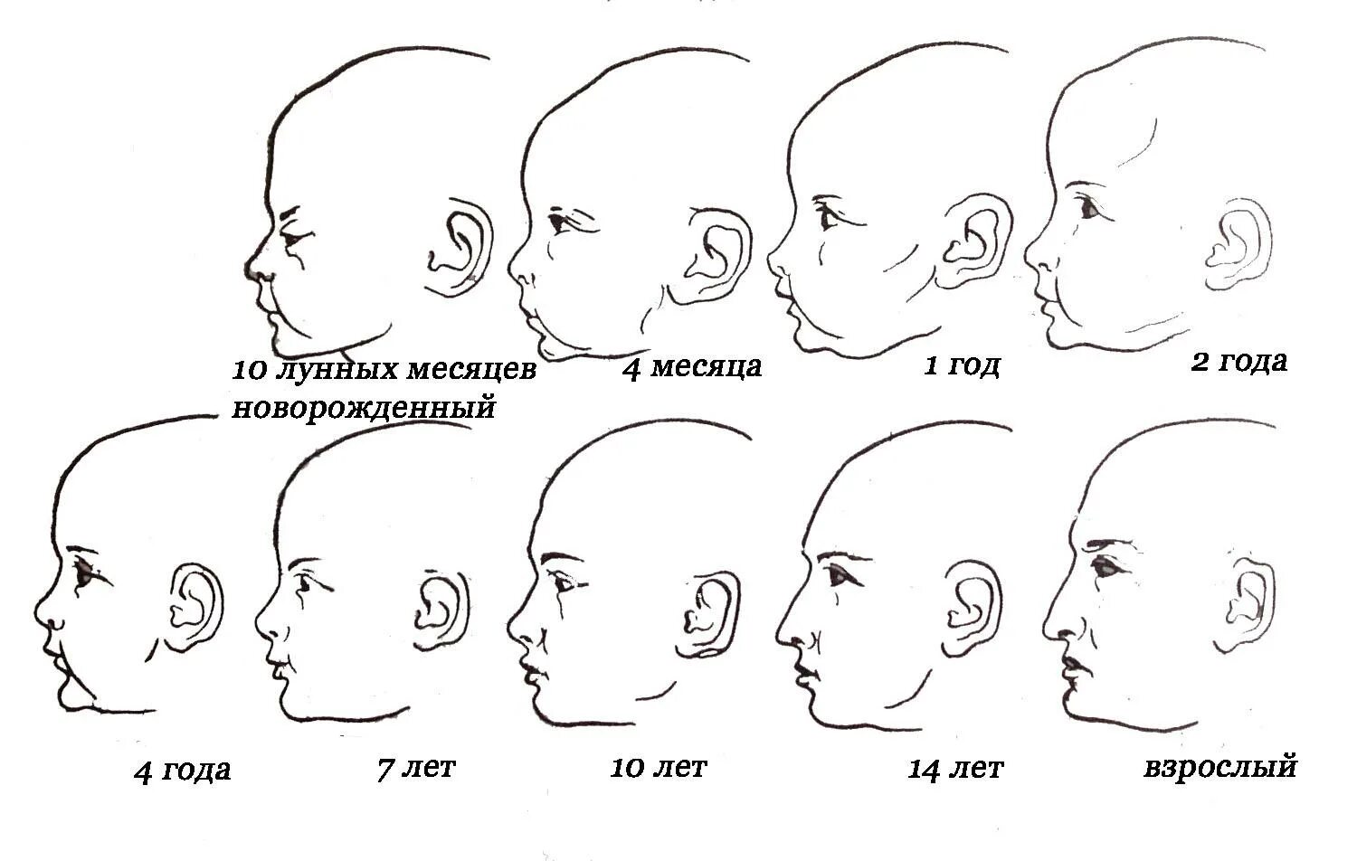 Вырасти по лицам. Форма черепа у младенца формируется. Нормальная форма черепа ребенка сбоку. Нормальная форма головы у грудничка сбоку. Развитие черепа у новорожденного ребенка.