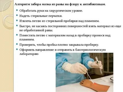 Взятие мазка на степень чистоты алгоритм