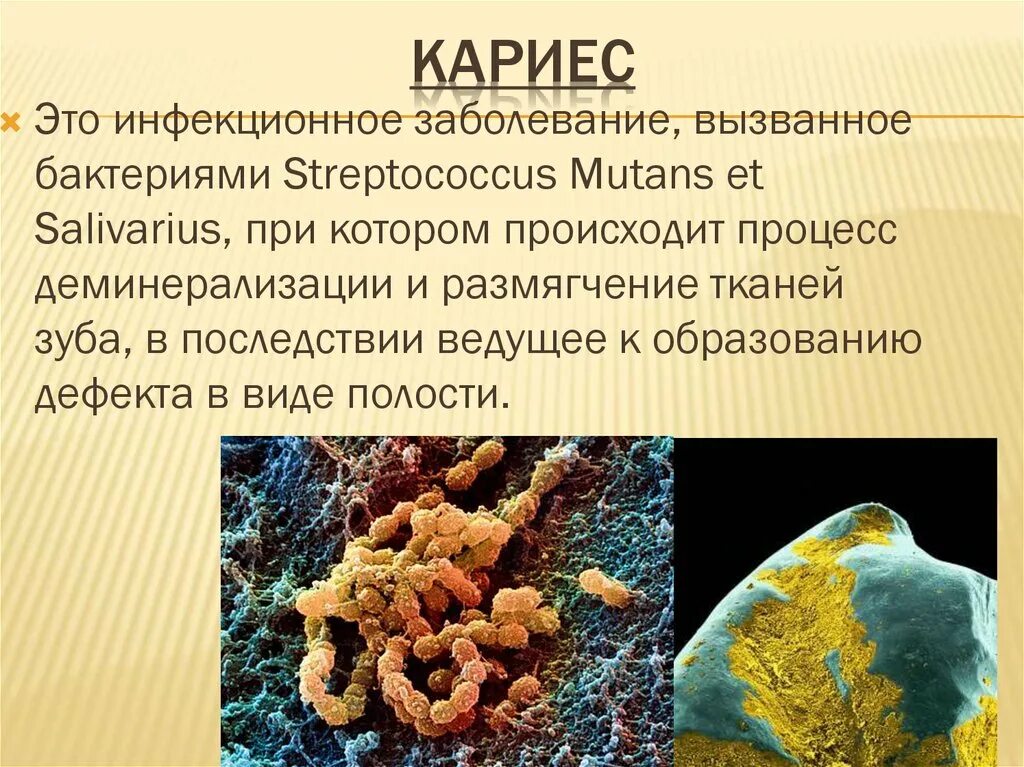 Кариес бактерии