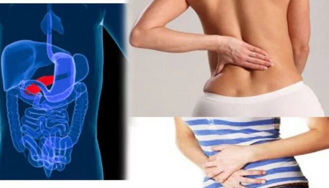 Симптомы поражения поджелудочной железы. Камни в поджелудочной железе симптомы. Поджелудочная железа симптомы болезни и лечение. Может ли панкреатит отдавать. Может ли панкреатит отдавать.