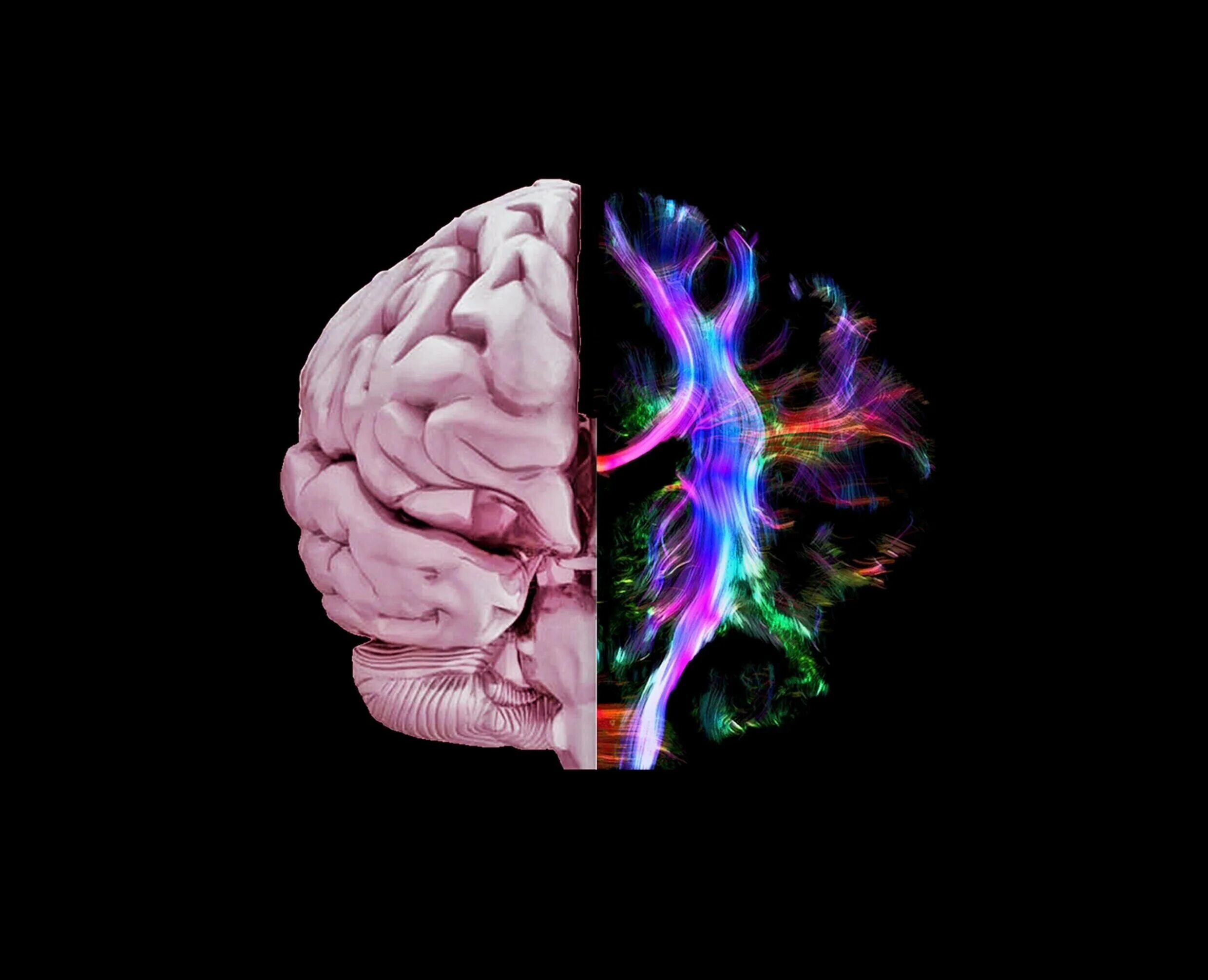 Colored brains. Трактография головного мозга. Мозг Эстетика.