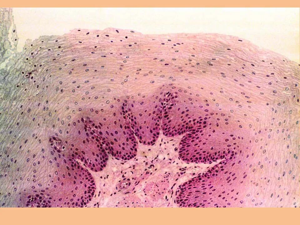 Увеличение больших половых. Эпителий гистология микропрепараты. Эпителий микропрепарат. Гистология ткани эпителия. Эпителиальная ткань гистология.