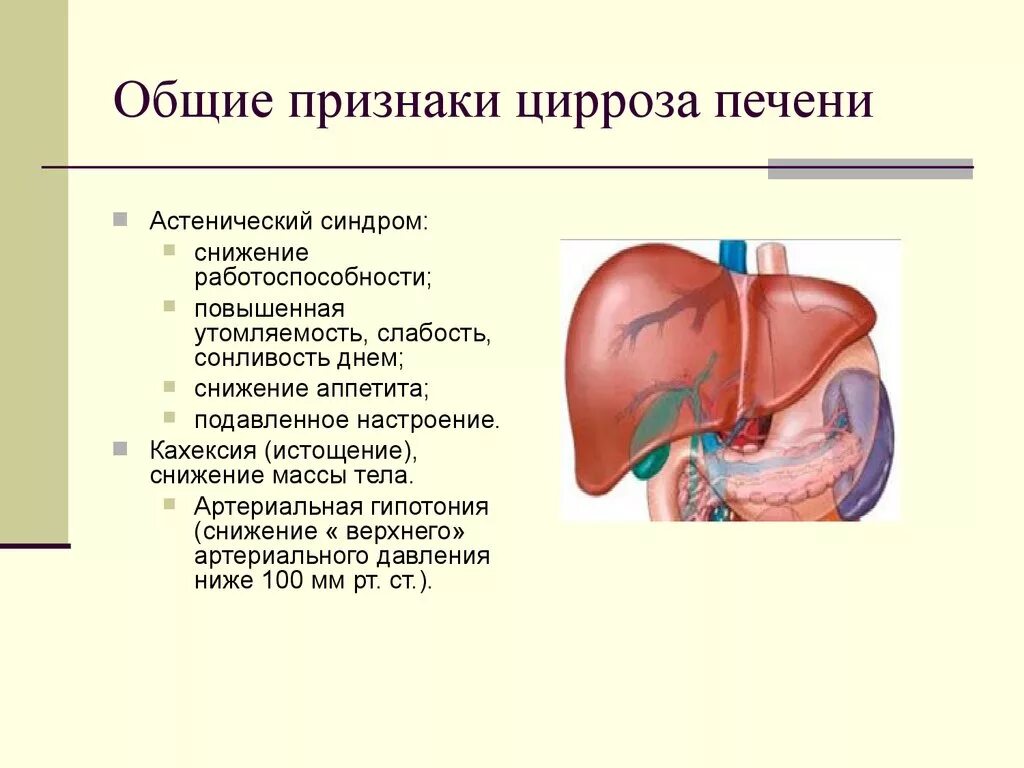 Цирроз печени синдромы основные. Характерные признаки цирроза печени. Цирроз печени ранние симптомы. 1 Причины цирроз печени. Первая помощь печени