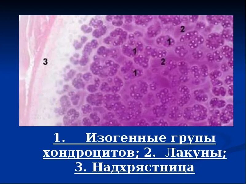 Изогенные группы. Изогенные группы хондроцитов. Изогенные клетки. Изогенная группа хондроцитов гистология. Соединительная ткань гиалиновый хрящ.