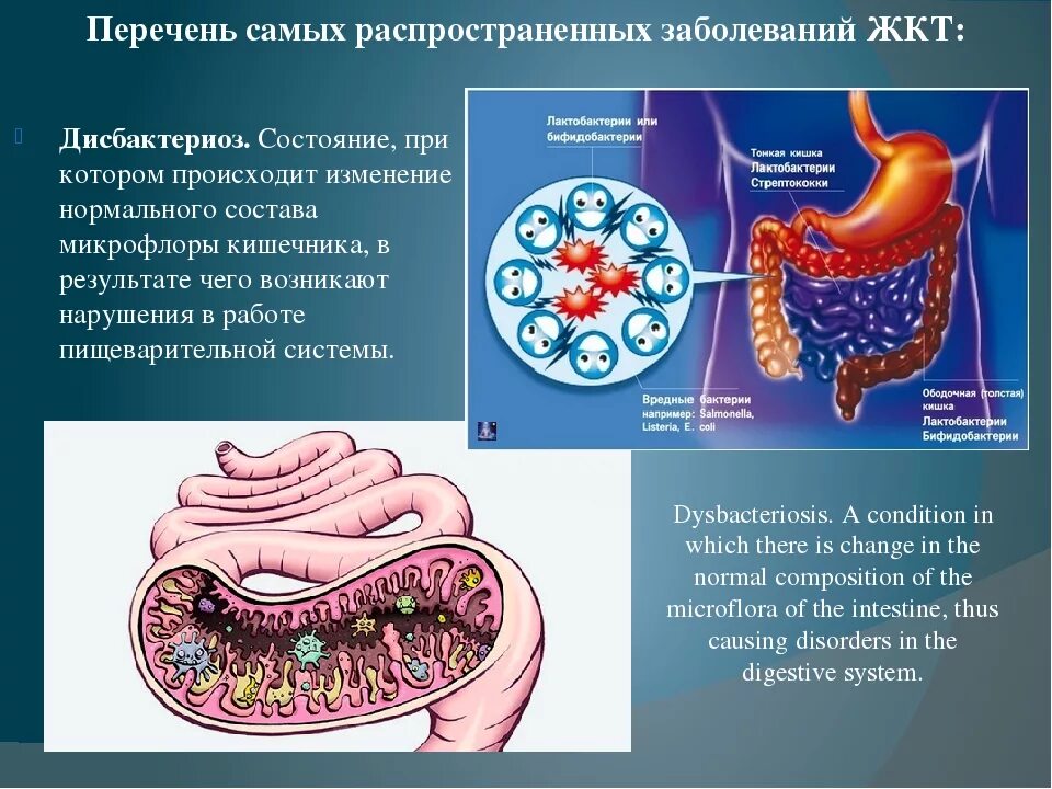 Вызывает заболевание кишечника. Заболевания пищеварительного тракта. Заболевания органов ЖКТ.