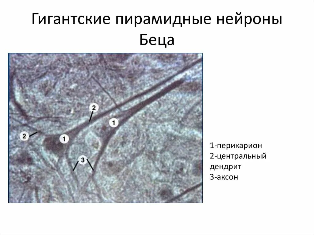 Пирамидальные нейроны
