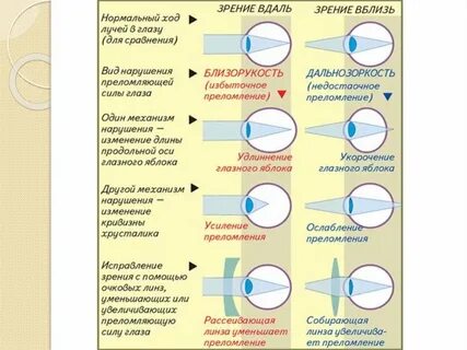 Близорукость и дальнозоркость плюс и минус