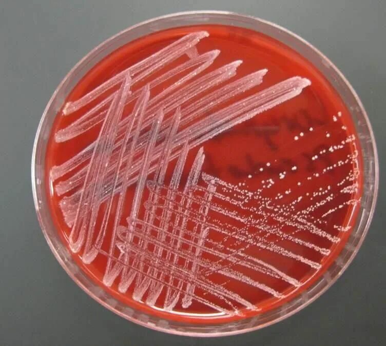 Иерсинии энтероколитика микробиология. Возбудитель Yersinia enterocolitica. Yersinia pseudotuberculosis на иерсинии агаре. Иерсиния энтероколитика иерсиниоз. Среда для кишечной палочки