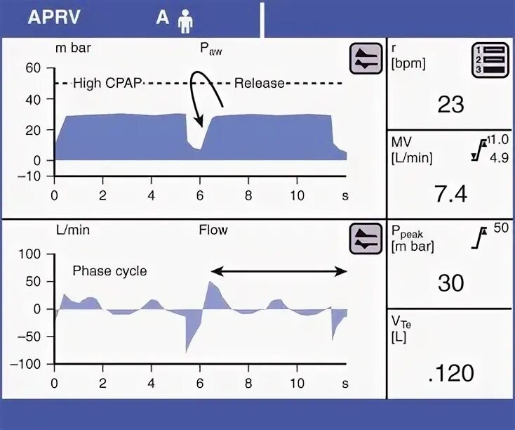 APRV режим вентиляции. APRV режим ИВЛ. Режимы вентиляции ИВЛ. Вентиляция с контролем по давлению ИВЛ. Вентиляционные режимы