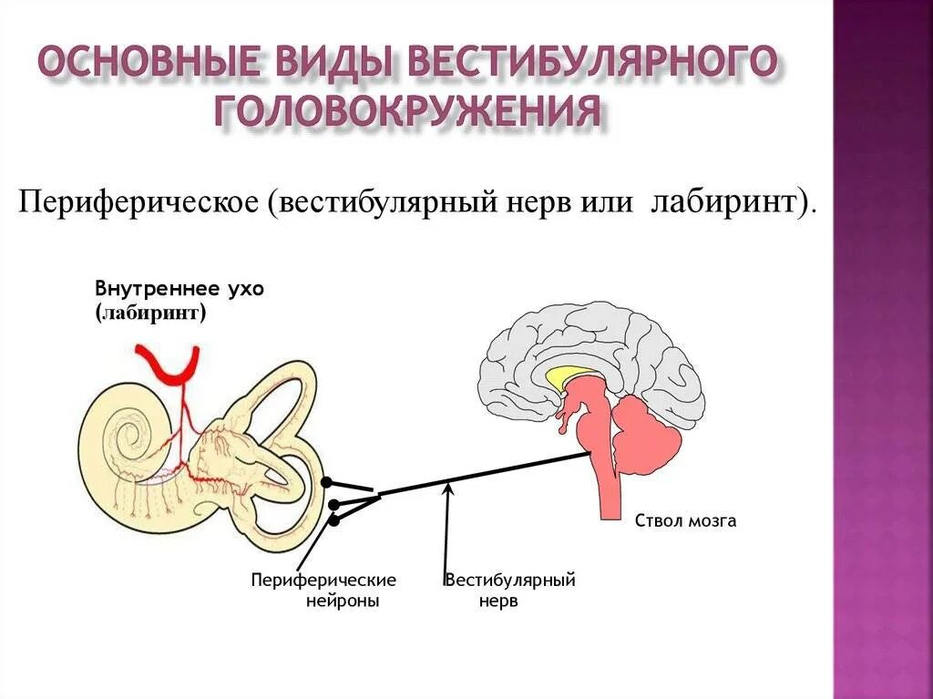 Нарушение вестибулярной функции. Вестибулярный нерв Лабиринт уха. Повреждение вестибулярного аппарата симптомы. Вестибулярное головокружение. Патология вестибулярного аппарата.