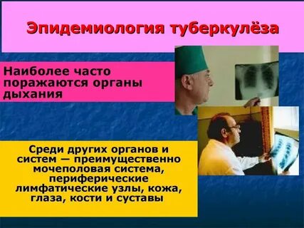 Туберкулез эпидемиология