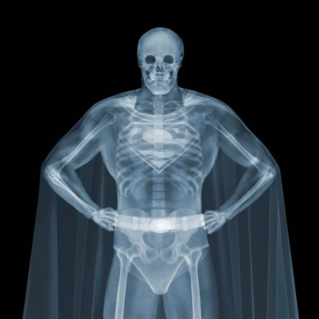 Рентген делают в одежде или нет. Фотограф рентген ник визи. x-ray рентген. смешные рентгеновские снимки.
