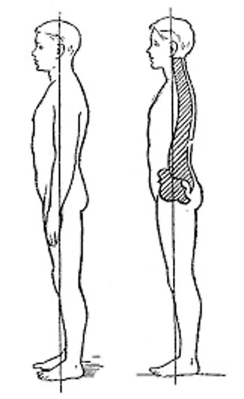 Вертикальное положение тела. Правильная осанка у человека. Вертикальное положение человека. Правильное расположение осанки.