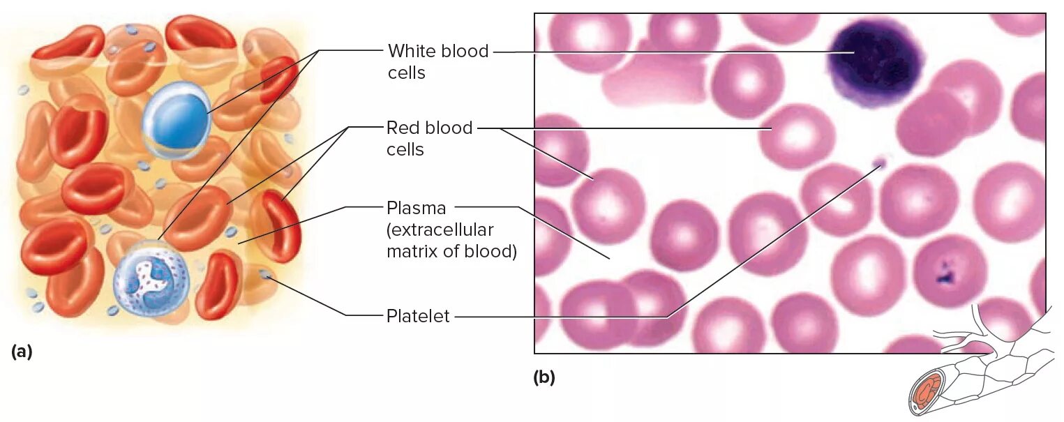 Цитоплазма эритроцитов человека. Эритроциты в крови. Различные формы эритроцитов. Эритроциты и лейкоциты. Эритроциты ядро.