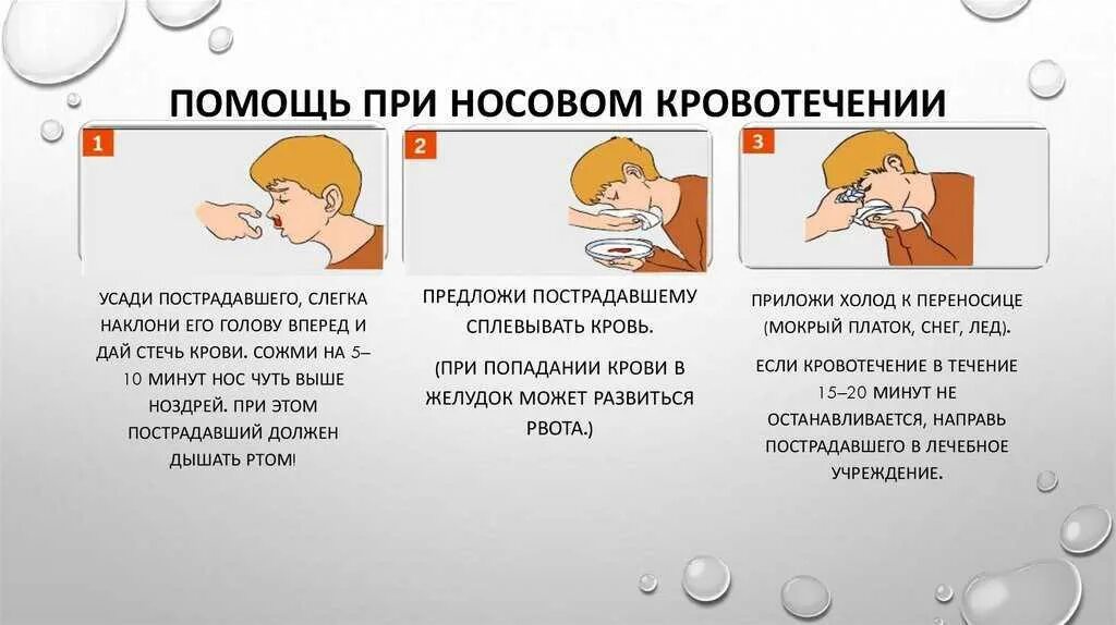 При носовом кровотечении выполняют