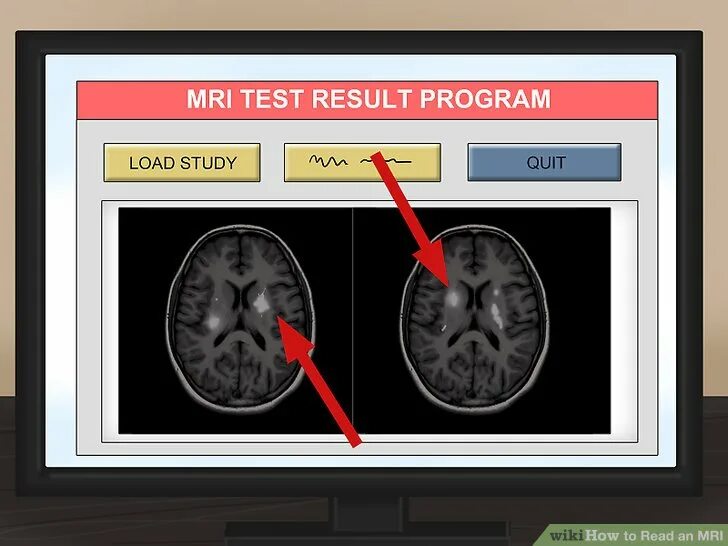 Как переслать диск мрт. Mri result. диск мрт. мрт на диске как посмотреть. диск с мрт пустой.