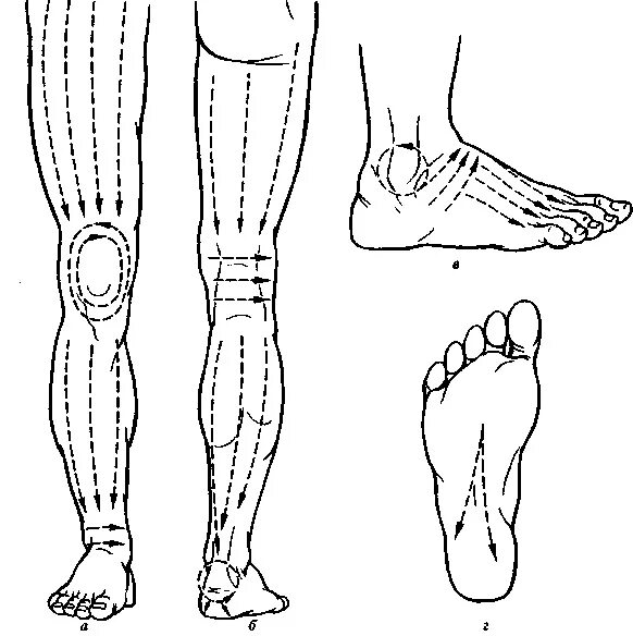 Массаж при полинейропатии нижних конечностей техника. Массаж ног при нейропатии нижних конечностей. Массаж при полинейропатии нижних и верхних конечностей. Массаж нижних конечностей схема.
