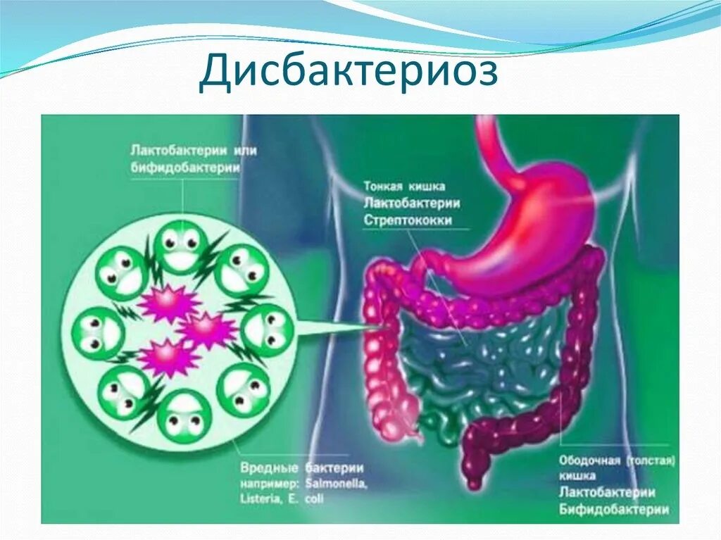 Роль бактерий толстого кишечника человека. Дисбактериоз микрофлоры кишечника. Дисбактериоз кишечника микроорганизмы. Микроорганизмы кишечника. Дисбактериоз кишечная микрофлора.